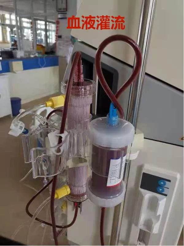 “換”出新生——重癥醫(yī)學(xué)科血液凈化技術(shù)成熟發(fā)展