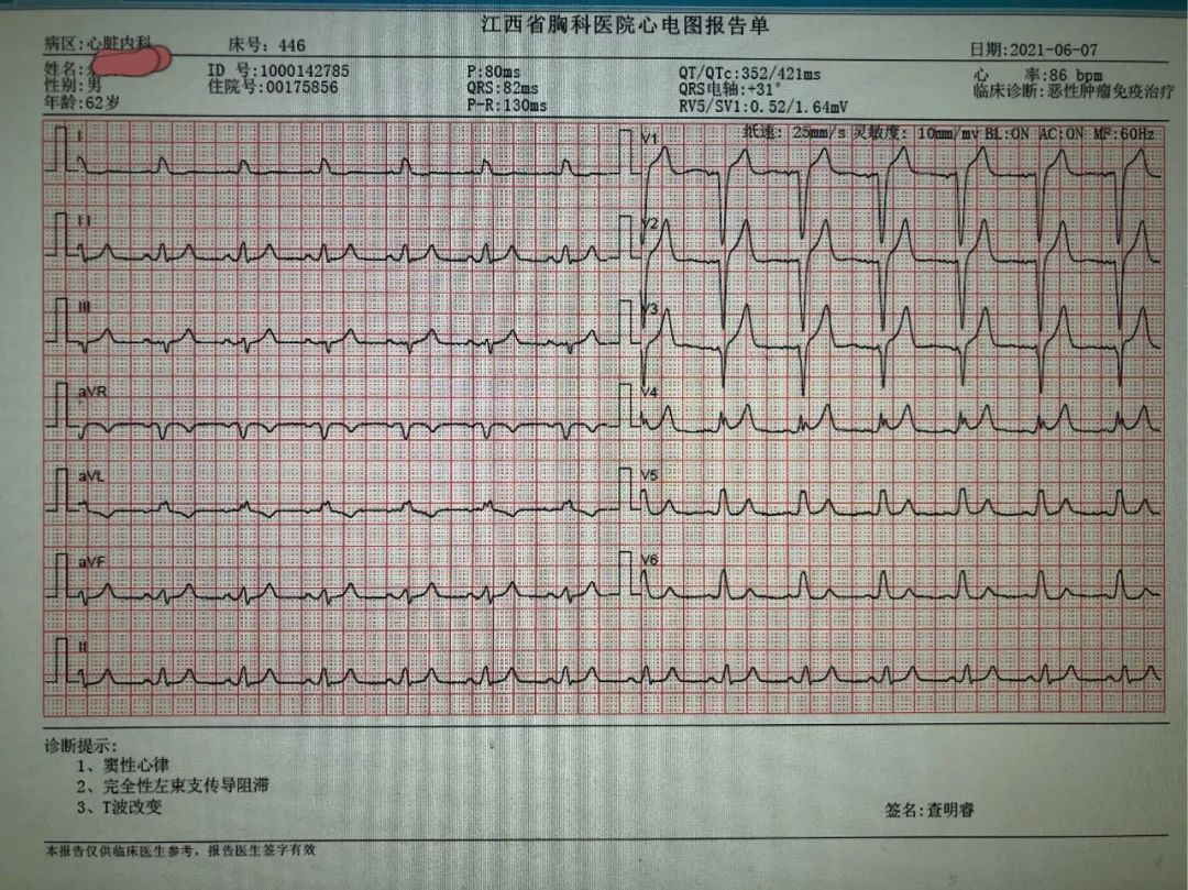 我院成功救治一例不典型免疫性心肌炎患者