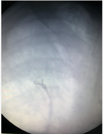 與時間賽跑，介入顯神通