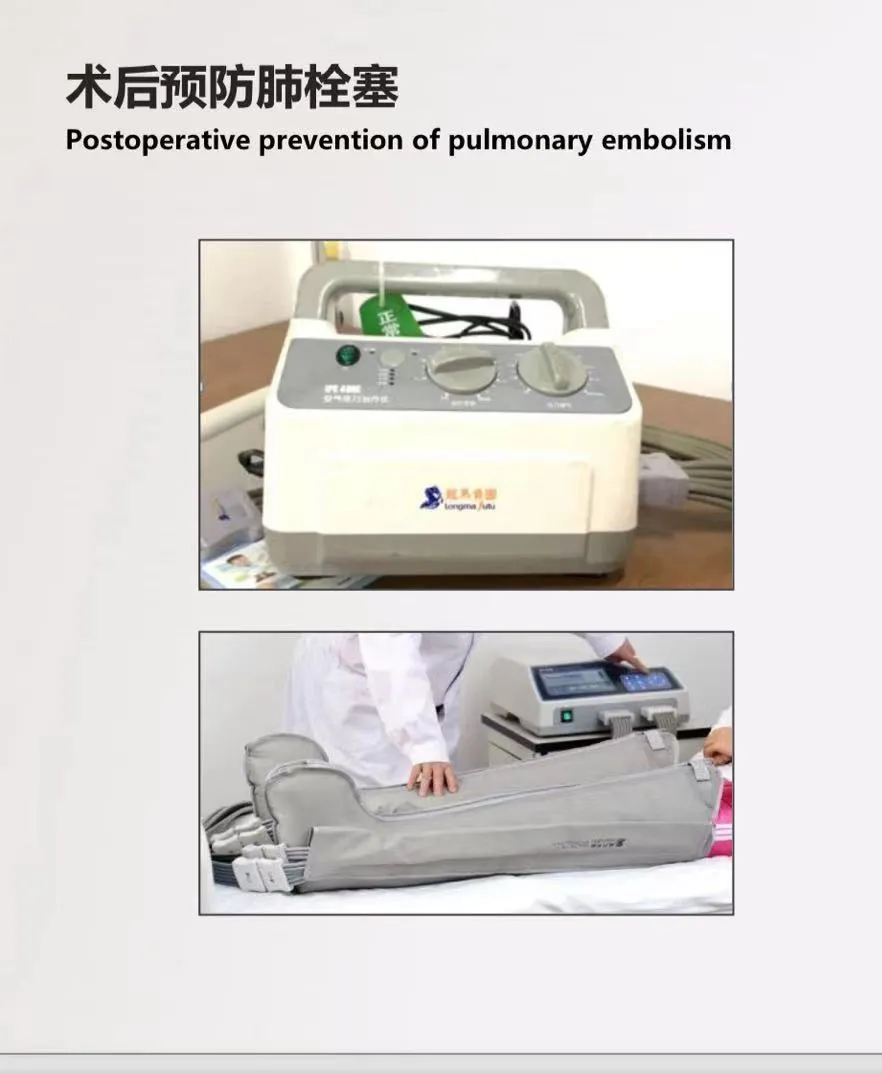 預(yù)防深靜脈血栓形成從細(xì)節(jié)做起