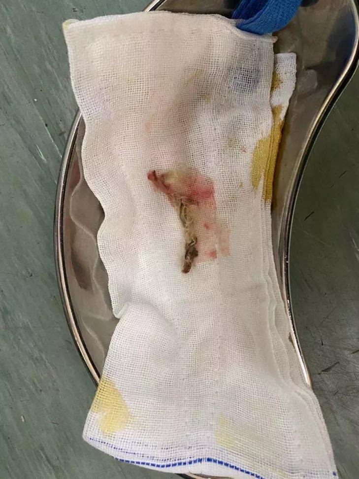 「驚愕」手術(shù)臺上忽見40多年的“老朋友”