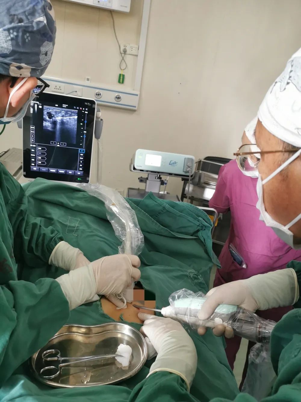 「硬實(shí)力」小切口解決大麻煩——乳腺微創(chuàng)旋切術(shù)讓美麗不留憾